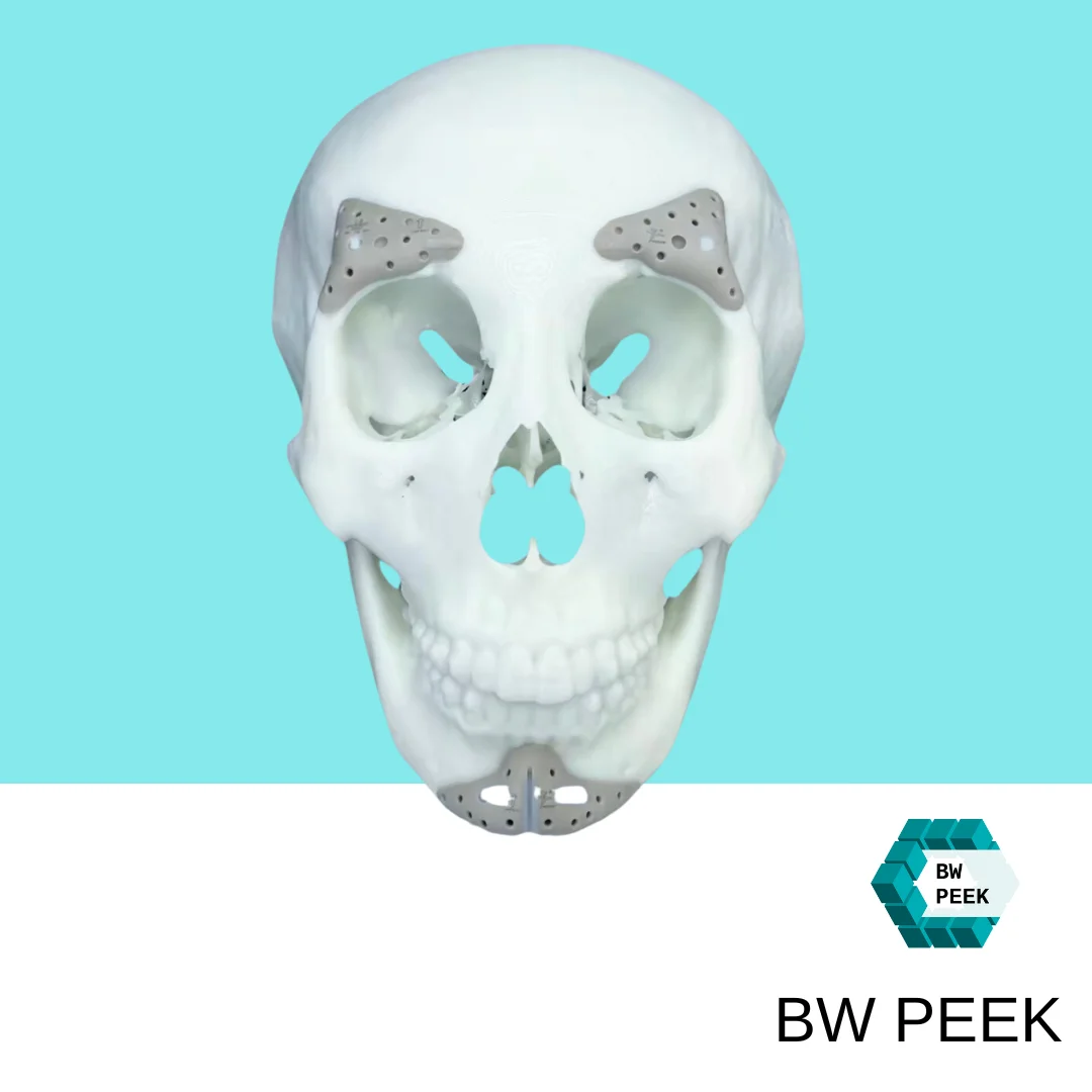 PEEK medical implant